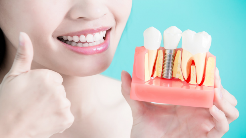 İMPLANTLAR İMPLANTLAR